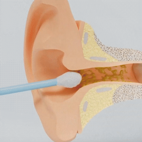 Hearen Smart Ear cleaner